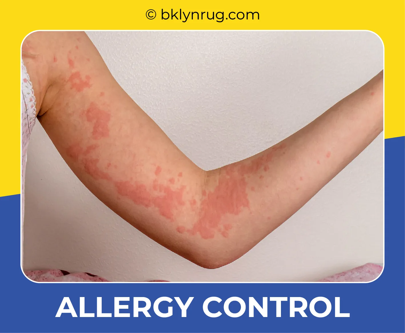 carpet cleaning in brooklyn, carpet cleaning in new york, carpet cleaning brooklyn, carpet cleaners in brooklyn, carpet cleaners in new york, commercial carpet cleaning, commercial carpet cleaning in brooklyn, brooklyn rug cleaners, rug cleaning services in brooklyn, same day carpet cleaning, same day rug cleaning